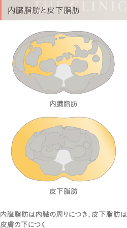 内臓脂肪と皮下脂肪の違い