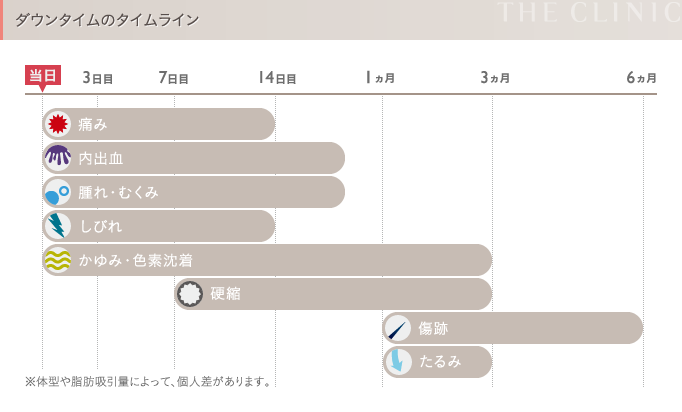 お腹の脂肪吸引のダウンタイム