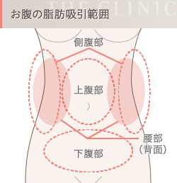 お腹の脂肪吸引範囲