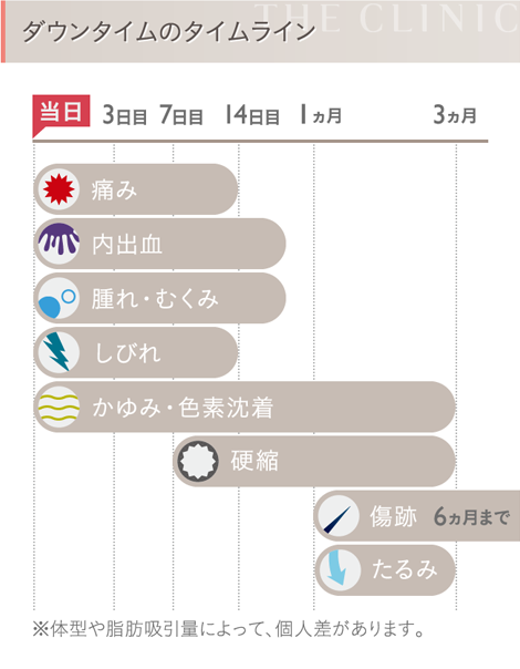 お腹の脂肪吸引のダウンタイム