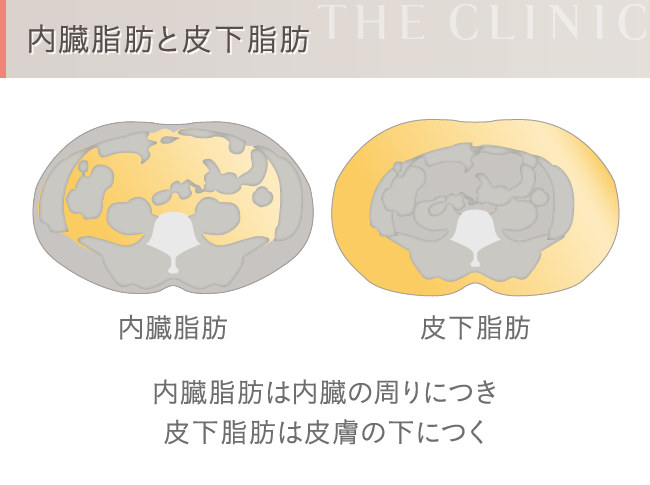 内臓脂肪と皮下脂肪の違い