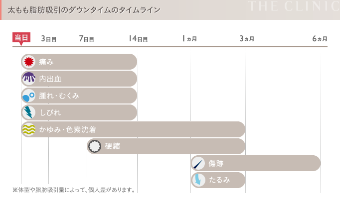 太ももの脂肪吸引 ダウンタイム