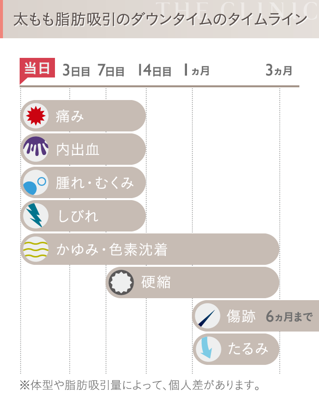 太ももの脂肪吸引 ダウンタイム