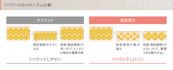 ダイエットと脂肪吸引 リバウンドのメカニズム比較