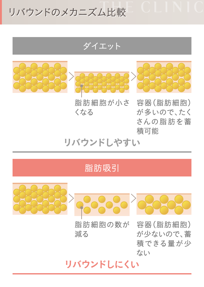 ダイエットと脂肪吸引 リバウンドのメカニズム比較